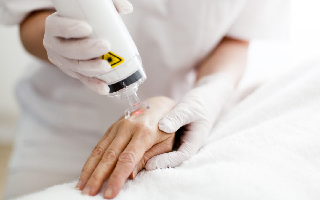 PowerPhotonic beam shapers and homogenisers adapt laser tattoo removal products for improved efficiency and performance.