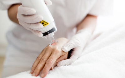 PowerPhotonic beam shapers and homogenisers adapt laser tattoo removal products for improved efficiency and performance.